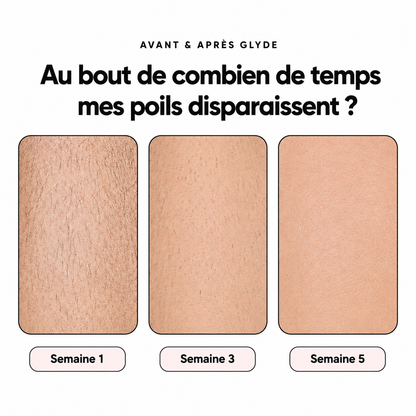 Glyde - épilateur à lumière pulsée